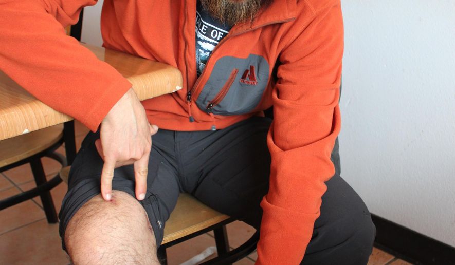 ADVANCE FOR THE WEEKEND OF SEPT. 24-25 AND THEREAFTER - In a Sept. 14, 2016 photo, UnCruise Adventures guide Michael Justa shows in Juneau, Ak., where he was bitten by a bear on Aug. 18, while hiking with a group of 22 guests near Sitka, Alaska. Justa was one of the two guides who were mauled by the bear on Sitkoh Lake Trail. Justa was the lesser injured of the two guides. (Lisa Phu/Juneau Empire via AP)