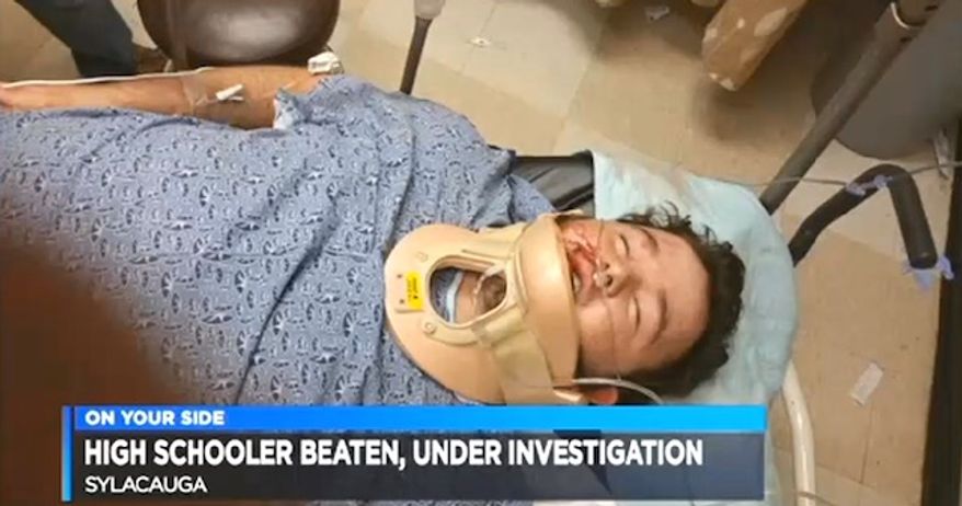 Brian Ogle of Sylacauga, Alabama, was assaulted Sept. 30, 2016, in a parking lot for a pro-cop message he posted on his Facebook page. (WBRC Fox 6 Alabama screenshot)