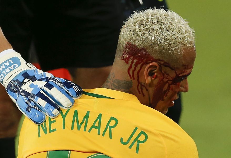 Bolivia goalie Carlos Emilio Lampe, right, checks on Brazil’s Neymar as he lies on the pitch with his face bleeding after a rough play during a 2018 World Cup qualifying soccer match against Bolivia, in Natal, Brazil, Thursday, Oct. 6, 2016. Brazil won the match 5-0. (AP Photo/Leo Correa)