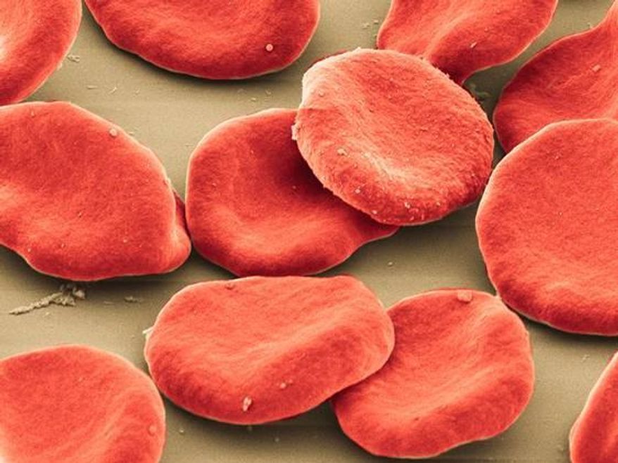 This photo provided by the University of Pittsburgh, Center for Biologic Imaging shows colorized scanning electron micrograph of red blood cells found in humans. (University of Pittsburgh, Center for Biologic Imaging via AP) ** FILE **