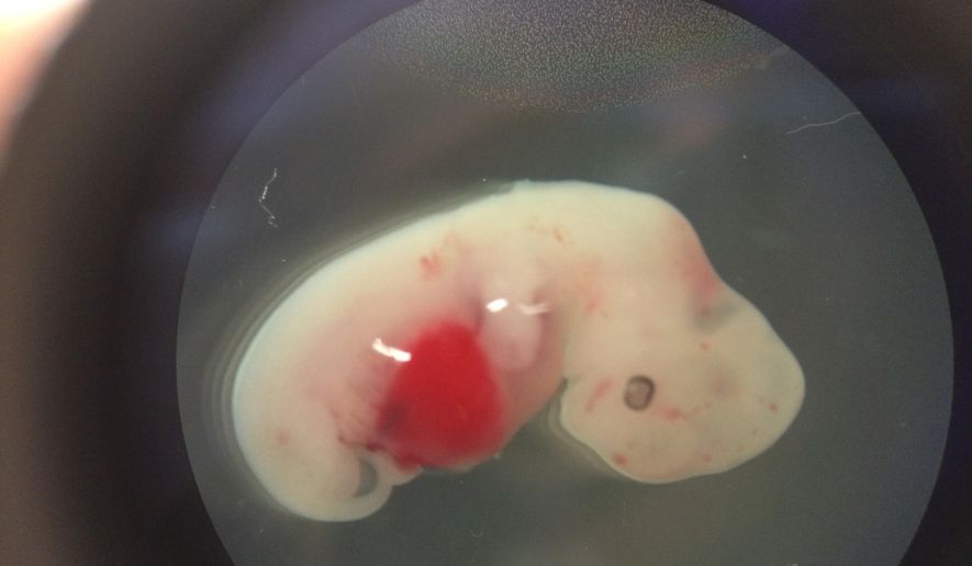 This undated photo provided by the Salk Institute on Jan. 24, 2017 shows a 4-week-old pig embryo which had been injected with human stem cells. The experiment was a very early step toward the possibility of growing human organs inside animals for transplantation. (Salk Institute via AP)
