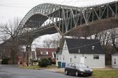 bridge_closed_fracture_53018.jpg