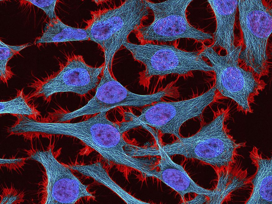 This undated microscope image made available by the National Center for Microscopy and Imaging Research shows HeLa cells. Until these cells came along, whenever human cells were put in a lab dish, they would die immediately or reproduce only a few times. Henrietta Lacks' cells, by contrast, grew indefinitely. They were "perpetual, everlasting, death-defying, or whatever other word you want to use to describe immortal," says Dr. Francis Collins, director of the U.S. National Institutes of Health. (National Center for Microscopy and Imaging Research via AP)