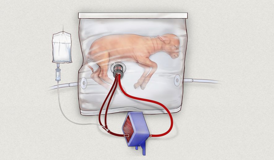 In this drawing provided by the Children’s Hospital of Philadelphia, an illustration of a fluid-filled incubation system that mimics a mother’s womb, in hopes of one day improving survival of extremely premature babies. In animal testing, fetal lambs grew for up to four weeks inside a bag filled with a substitute for amniotic fluid, while the heart pumped blood into a machine attached to the umbilical cord that supplied oxygen like a placenta normally would. (Children’s Hospital of Philadelphia via AP)