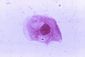 liberia_mystery_illness_29858.jpg