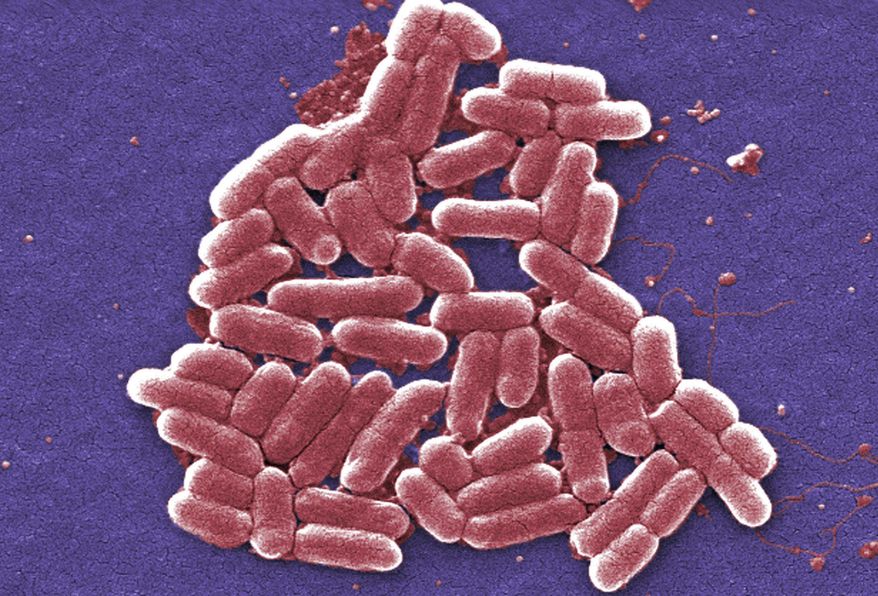 This 2006 colorized scanning electron micrograph image made available by the Centers for Disease Control and Prevention shows a strain of the Escherichia coli bacteria. E. coli is one of the germs that can cause sepsis. Once misleadingly called blood poisoning or a bloodstream infection, sepsis occurs when the body goes into overdrive while fighting an infection, sort of friendly fire that injures its own tissue. The cascade of inflammation and other damage leads to shock, amputations, organ failure or death. (Janice Carr/CDC via AP)