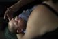 puerto_rico_zika_birth_defect_10546.jpg
