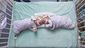 conjoined_twins_separated_70402.jpg