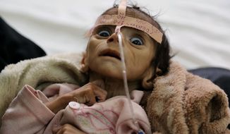 In this March 22, 2016 photo, Udai Faisal, an infant suffering from acute malnutrition, who died on March 24, is hospitalized at Al-Sabeen Hospital in Sanaa, Yemen. More than two years of civil war have led to continually compounding disasters in Yemen. Fighting rages on in a deadly stalemate, the economy has been bombed into ruins, hunger is widespread, and a new misery has been added: Cholera, the world’s biggest current outbreak with more than 200,000 cases. (AP Photo/Maad al-Zikry, File)