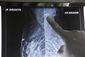 west_africa_cancer_patients_22692.jpg