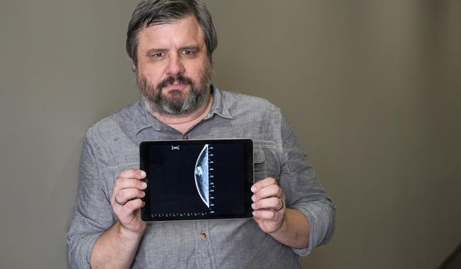In this July 13, 2017 photo, Associated Press reporter Andrew Dalton holds an iPad displaying an image of his mammogram in downtown Los Angeles. Dalton described his experience as the rare man who underwent a mammogram in a story for the AP.  (AP Photo/Richard Vogel)