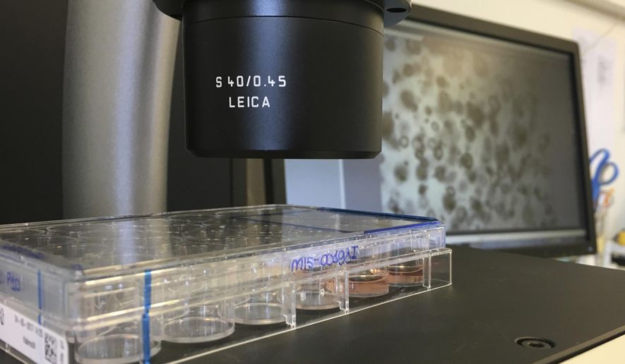 Samples of mini organs are magnified with microscope at the Hubrecht Institute in Utrecht, Netherlands on Monday, May 29, 2017. Doctors in the Netherlands are aiming to grow mini intestines for cystic fibrosis patients to figure out what drugs might work for them. (AP Photo/Aleksandar Furtula)