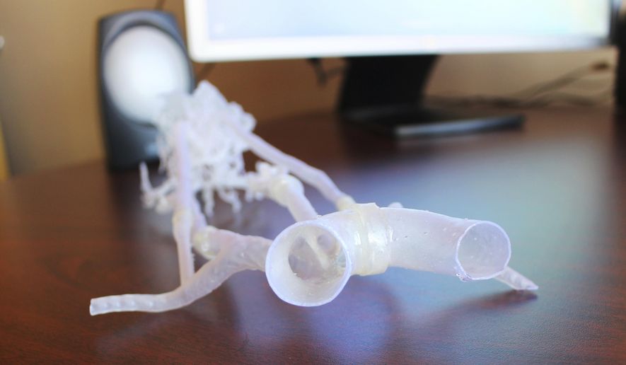 This Wednesday Oct. 17, 2017 photo t UConn's John Dempsey Hospital in Farmington, Conn, shows a 3-D printed model of the arteries and blood vessels running from the heart to the brain. Staff at the hospital found a way to turn medical scans of the vessels into models that can be used by doctors to practice removing blood clots from stroke patients. . (AP Photo/Pat Eaton-Robb)