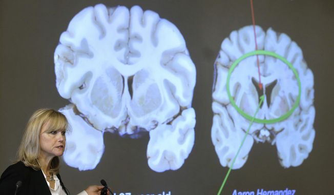 Ann McKee, director Boston University&#x27;s center for research into the degenerative brain disease chronic traumatic encephalopathy, or CTE, shows a scan of NFL football player Aaron Hernandez&#x27;s brain. The cross section of the brain projected at left is labeled a normal 27-year-old. Researchers say they have found a way to diagnose CTE in living patients. (AP Photo/Steven Senne)