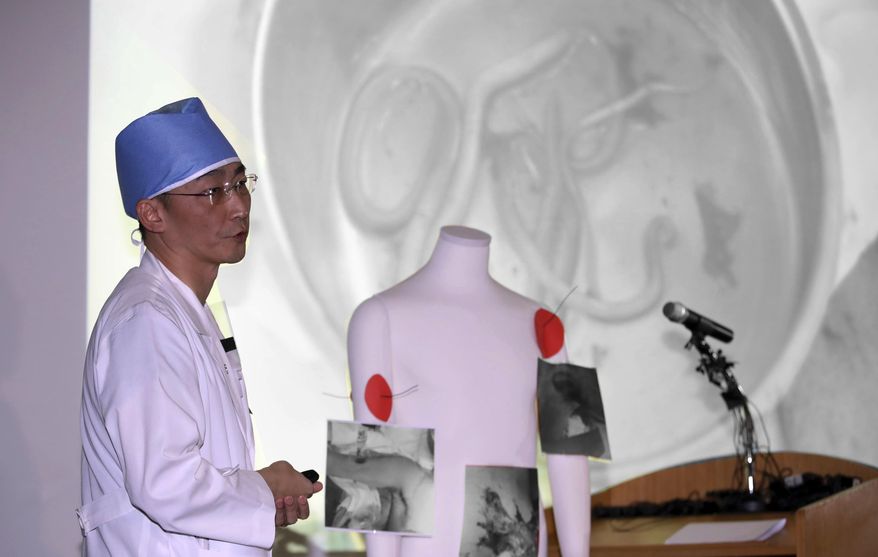 FILE - in this Nov. 15, 2017, photo, medical doctor Lee Cook-jong describes the parasites found inside the body of a North Korean soldier at Ajou University Medical Center in Suwon, South Korea. Hospital officials say on Saturday, Nov. 18, 2017, the condition of the North Korean soldier severely wounded by gunfire while escaping to South Korea is gradually improving after two surgeries but it's too early to tell whether he makes a recovery.(Kim In-chul/Yonhap via AP, File)