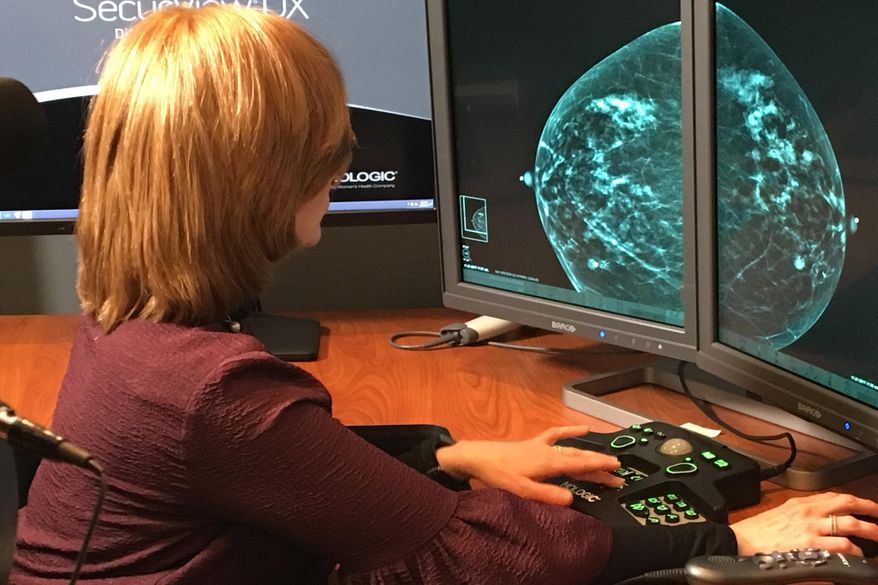 In this Nov. 21, 2017, photo provided by the Montefiore Health System, Dr. Tova Koenigsberg at The Montefiore Einstein Center for Cancer Care in New York shows an example of a traditional mammogram scan. U.S. health officials are beginning a huge study to compare traditional mammograms with 3-D versions to see if the newer choice might really improve screening for breast cancer. (Montefiore Health System via AP)