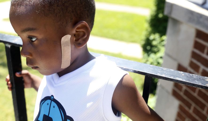FILE - In this July 19, 2016 file photo, Kavan Collins, stands on his father's porch in Chicago. Collins was shot on June 28, 2016, while holding his mother's hand on the city's South Side. One of the bullets had struck him in his face, fracturing his jaw. Chicago police say Collins accidentally shot himself in the hand Tuesday, Dec. 19, 2017 at a home on the city's South Side. Investigators are trying to determine how he got the handgun and are questioning a man who was in the home at the time of the shooting. (AP Photo/Tae-Gyun Kim File)