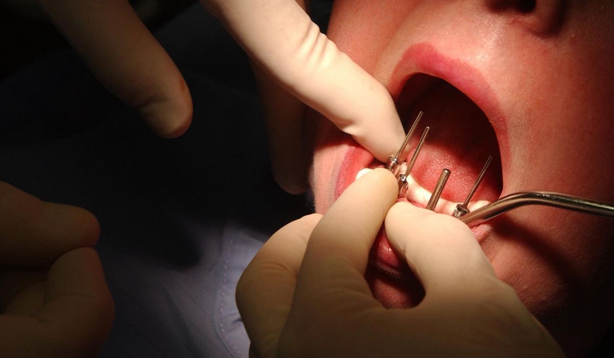 NextImg:Groundbreaking human trial for tooth regeneration drug set to begin
