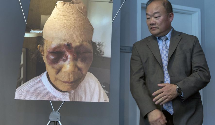 Los Angeles Police Detective Heebae Cho stands next to a photo of a crime victim Mi Reum Song during a news conference in Los Angeles Monday, Feb. 12, 2018. The photo was taken by her granddaughter, Yujin Audrey Ko, and posted on Facebook after an attack Saturday, in the Koreatown neighborhood. Police are looking for the man who attacked the woman, leaving her face bruised in what her family has called a random and unprovoked attack. (AP Photo/Damian Dovarganes)