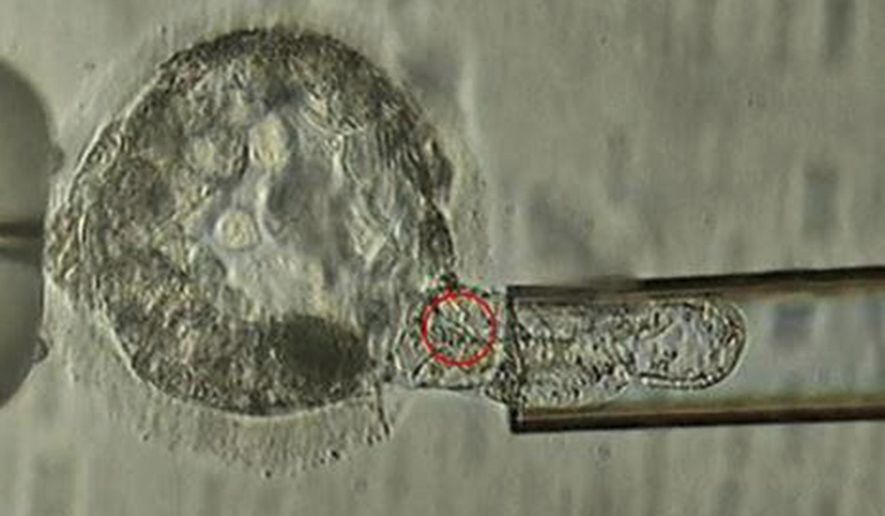This undated microscope image provided by the American Society for Reproductive Medicine in January 2018 shows a trophectoderm biopsy, in which cells from the outer layer of an embryo that develop into the placenta and amniotic membranes are removed and can be used for genetic testing. When a couple is known to be at risk for having a child with a specific genetic disorder, the woman undergoes a procedure to remove some of her eggs. After fertilization, some cells can be plucked from the embryos and examined to identify those without carry the disease-causing abnormality. (ASRM via AP)Wedn