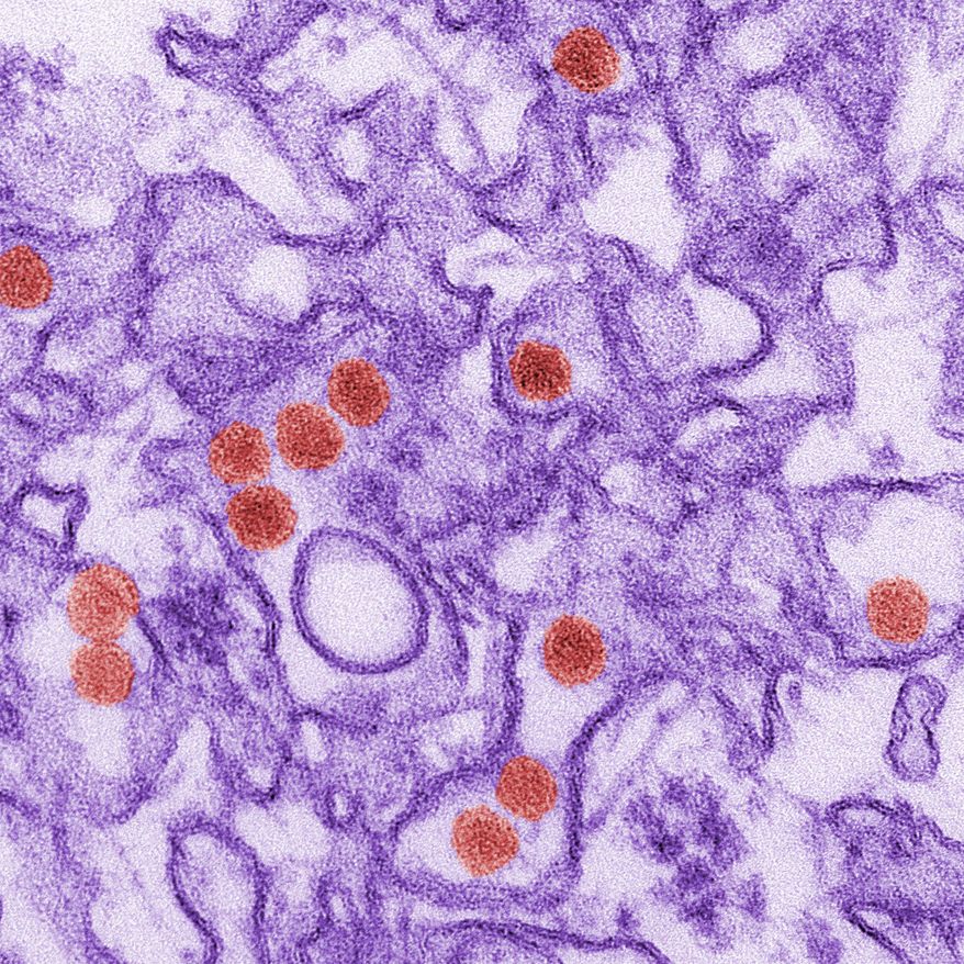FILE - This 2016 digitally-colorized electron microscope image made available by the Centers for Disease Control and Prevention shows the Zika virus, in red, about 40 nanometers in diameter. According to a study released on Wednesday, May 9, 2018, screening millions of blood donations for the Zika virus has netted only a few infections, raising questions about whether the costly current level of testing should continue. (Cynthia Goldsmith/CDC via AP)