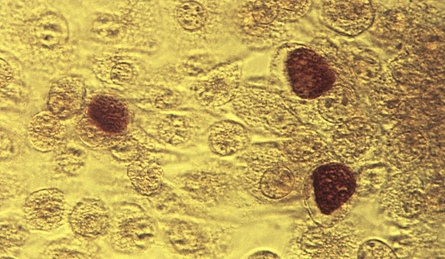 This 1975 microscope image made available by the the Centers for Disease Control and Prevention shows Chlamydia trachomatis bacteria magnified 200X. A report by the CDC released on Wednesday, Oct. 19, 2016 says infections from three sexually spread diseases have hit another record high. Chlamydia was the most common. More than 1.5 million cases were reported in the U.S. last year, up 6 percent from the year before. (Dr. E. Arum, Dr. N. Jacobs/CDC via AP)