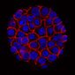 This undated microscope image from USC via the NIH shows pancreatic cancer cells, nuclei in blue, growing as a sphere encased in membranes, red. In a rare triumph for tough-to-beat pancreatic cancer, patients who had surgery lived substantially longer on a four-drug combo than on a standard cancer drug, according to research released on Monday, June 4, 2018. (Min Yu/Eli and Edythe Broad Center for Regenerative Medicine and Stem Cell Research at USC, USC Norris Comprehensive Cancer Center)