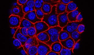 This undated microscope image from USC via the NIH shows pancreatic cancer cells, nuclei in blue, growing as a sphere encased in membranes, red. In a rare triumph for tough-to-beat pancreatic cancer, patients who had surgery lived substantially longer on a four-drug combo than on a standard cancer drug, according to research released on Monday, June 4, 2018. (Min Yu/Eli and Edythe Broad Center for Regenerative Medicine and Stem Cell Research at USC, USC Norris Comprehensive Cancer Center)