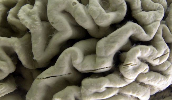 This Oct. 7, 2003, photo shows a section of a human brain with Alzheimer&#x27;s disease on display at the Museum of Neuroanatomy at the University at Buffalo, in Buffalo, N.Y. (Associated Press) ** FILE **