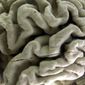 This Oct. 7, 2003, photo shows a section of a human brain with Alzheimer&#39;s disease on display at the Museum of Neuroanatomy at the University at Buffalo, in Buffalo, N.Y. (Associated Press) ** FILE **