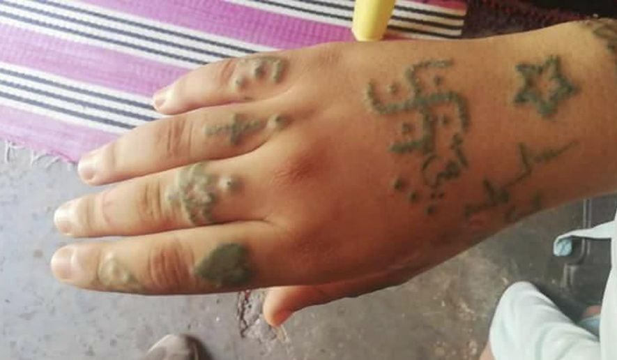 This undated photo provided by febrayer.com website appears to show tattoo marks on a 17-year-old Moroccan girl who told police she was gang-raped, forcibly tattooed and held against her will for two months, in Oulad Ayad, near Beni Melal, central Morocco. The girl's lawyer says authorities have arrested 12 suspects in a case that's sparking fresh public outcry over women's rights and sexual abuse in the North African kingdom. The Moroccan government has so far declined to comment on the girl's harrowing account. Local police confirmed to The Associated Press that there have been arrests in the case, but wouldn't say how many or give details.(Febrayer.com via AP)