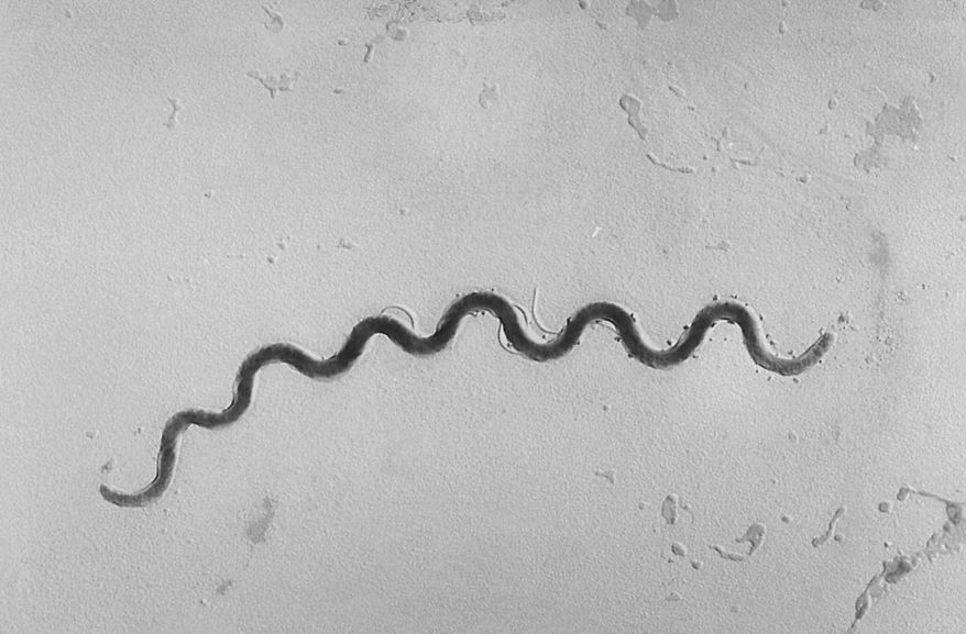 This 1972 microscope image provided by the Centers for Disease Control and Prevention shows a Treponema pallidum bacterium, which causes the disease syphilis. A report released on Tuesday, Sept. 25, 2018, says that newborn syphilis infections are surging to the highest level in 20 years. (Susan Lindsley/CDC via AP)