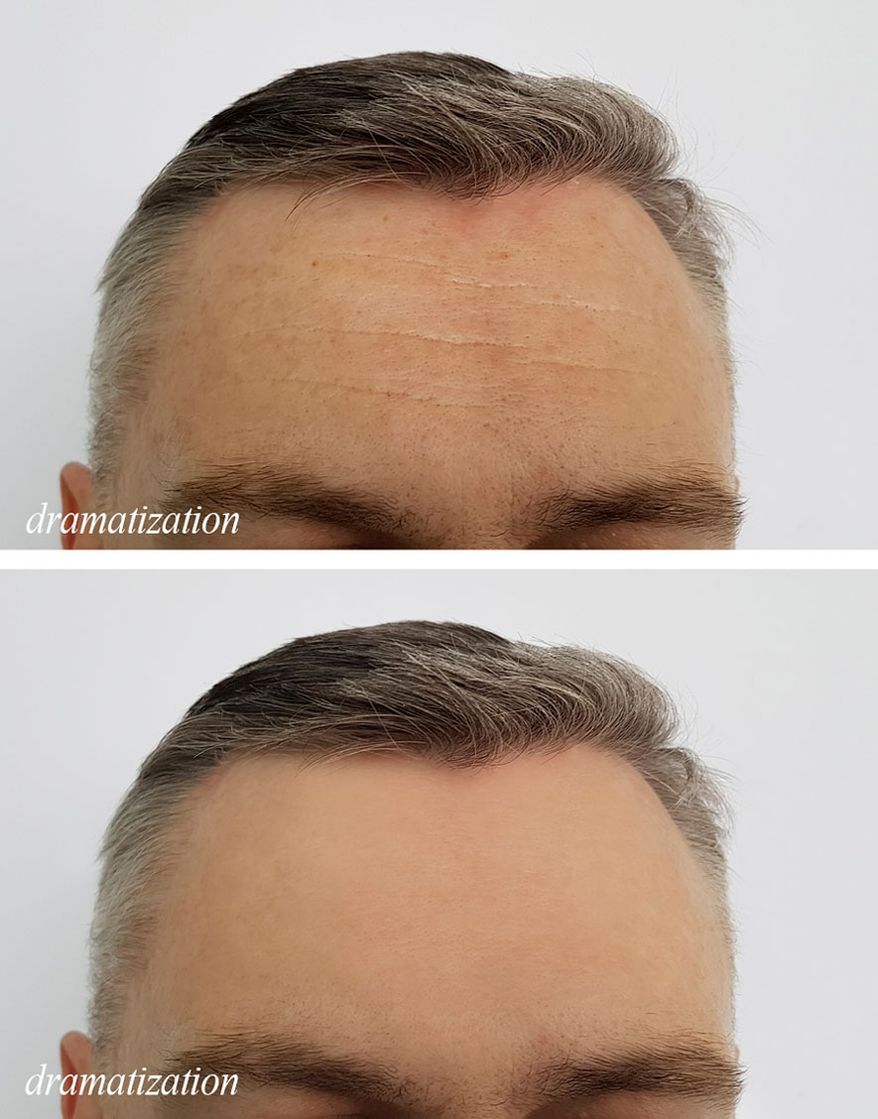 Conservative Men Don’t Get Facelifts. Learn How This 58-Year Old Gave His Aging Skin A Tighter, Younger Look Without Surgery (SPONSORED)