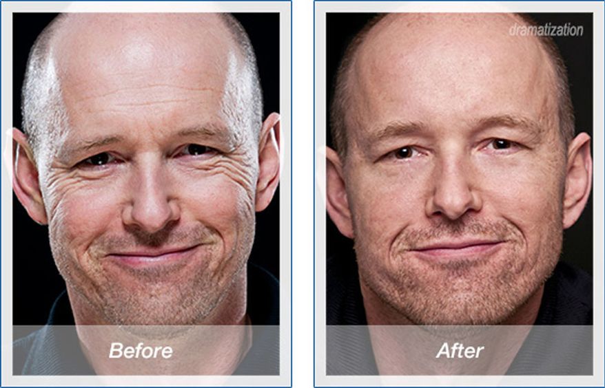 The Skin Tightener Every Man Should Own, Period. (SPONSORED)