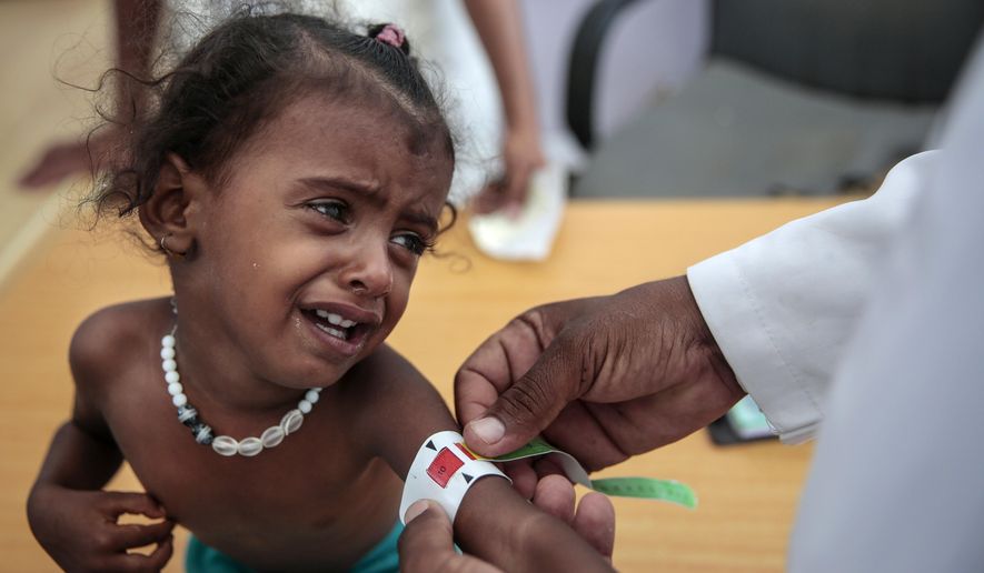 FILE - In this Oct. 1, 2018, file, photo, a doctor measures the arm of a malnourished girl at the Aslam Health Center, Hajjah, Yemen. A UN report says feeding a hungry planet is growing increasingly difficult as climate change and depletion of land and other resources undermines food systems. A U.N. Food and Agricultural Organization report released Wednesday, Nov. 28, 2018, said population growth requires supplies of more nutritious food at affordable prices. But raising farm output is hard given the fragility of the environment given that use of resources has outstripped Earth’s carrying capacity in terms of land, water, and climate change. (AP Photo/Hani Mohammed, File)