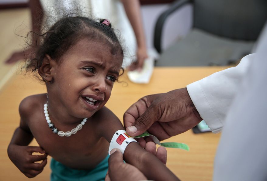FILE - In this Oct. 1, 2018, file, photo, a doctor measures the arm of a malnourished girl at the Aslam Health Center, Hajjah, Yemen. A UN report says feeding a hungry planet is growing increasingly difficult as climate change and depletion of land and other resources undermines food systems. A U.N. Food and Agricultural Organization report released Wednesday, Nov. 28, 2018, said population growth requires supplies of more nutritious food at affordable prices. But raising farm output is hard given the fragility of the environment given that use of resources has outstripped Earth’s carrying capacity in terms of land, water, and climate change. (AP Photo/Hani Mohammed, File)