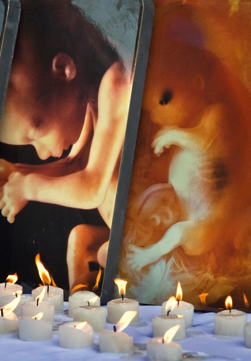 Candles and signs with pictures of fetus are seen during a protest against the legalization of abortion in front of the Supreme Court in Mexico City, Sunday Dec. 28, 2008. The law allows any woman, who can prove to be a resident of Mexico City, to have an abortion practiced at any public hospital, within the first 12 weeks of pregnancy . In Mexico, abortion is allowed only in cases of rape, when the mother's life is in danger or if the fetus has severe deformities. (AP Photo/ Claudio Cruz)