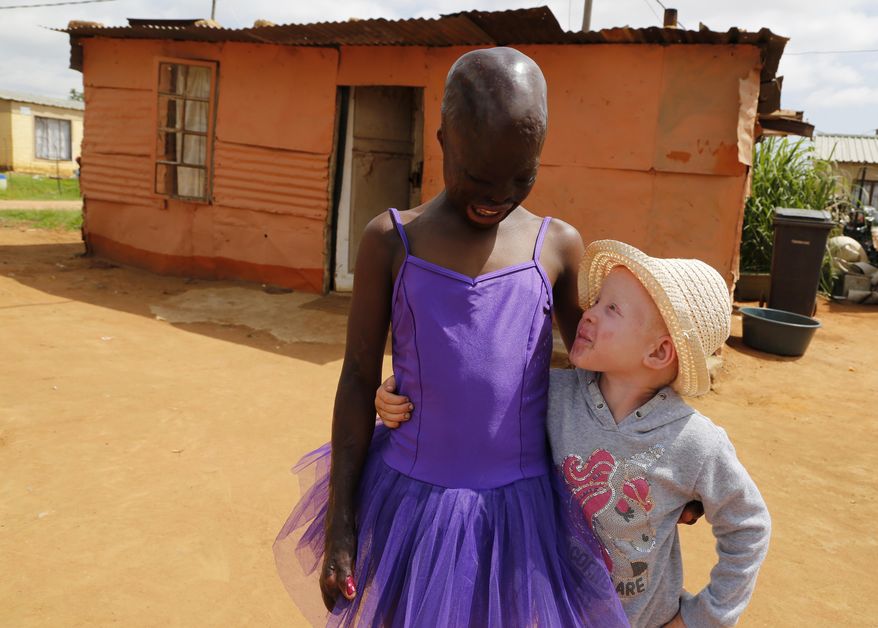 In this photo taken Sunday, Jan 6, 2019, 11-year-old burn victim Perlucia Mathebule, left, and her 4-year-old sister, Buhle who has albinism, pose for a photograph outside their one-room shack in Ekangala, South Africa, where the two are spending rare time with one another during the school holidays. Perlucia was badly burned at the age of 6 months and Buhle was born with albinism. (AP Photo/Denis Farrell)