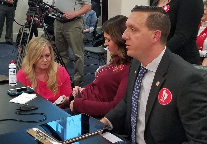 April Lanham, center, undergoes a procedure in Frankfort, Ky., that allows the audience at a Kentucky legislative meeting to hear her unborn son's heartbeat, Thursday, Feb. 14, 2019 in Frankfort, Ky. Her appearance came shortly before a Kentucky Senate committee advanced a bill that would ban most abortions in the state once a fetal heartbeat is detected. (Tom Latek/Kentucky Today via AP)