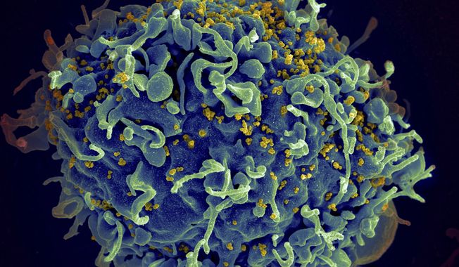 This electron microscope image made available by the U.S. National Institutes of Health shows a human T cell, in blue, under attack by HIV, in yellow, the virus that causes AIDS. The virus specifically targets T cells, which play a critical role in the body's immune response against invaders like bacteria and viruses. Colors were added by the source. On Thursday, March 6, 2019, researchers reported that monthly shots of HIV drugs worked as well as daily pills to control the virus that causes AIDS in two large international tests. (Seth Pincus, Elizabeth Fischer, Austin Athman/National Institute of Allergy and Infectious Diseases/NIH via AP)