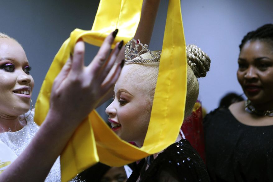 Ayanda Sibanda smiles, after being crowned Miss Albinism Zimbabwe 2019 at an albino pageant held in Harare, early Saturday, May 25, 2019. About 70,000 of Zimbabwe’s estimated 16 million people are born with albinism, according to government figures. They often stand out, making them a subject at times of discrimination, ridicule and dangerously misguided beliefs. The Mr. and Miss Albinism Zimbabwe competition, now in its second year, is a chance to push back. (AP Photo/Tsvangirayi Mukwazhi)