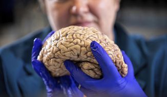 In this Aug. 14, 2019 photo provided by the University of Kentucky, Donna Wilcock, of the Sanders-Brown Center on Aging, holds a brain in her lab in Lexington, Ky. She says that contrary to popular perception, &amp;quot;there are a lot of changes that happen in the aging brain that lead to dementia in addition to plaques and tangles.&amp;quot; (Mark Cornelison/University of Kentucky via AP)