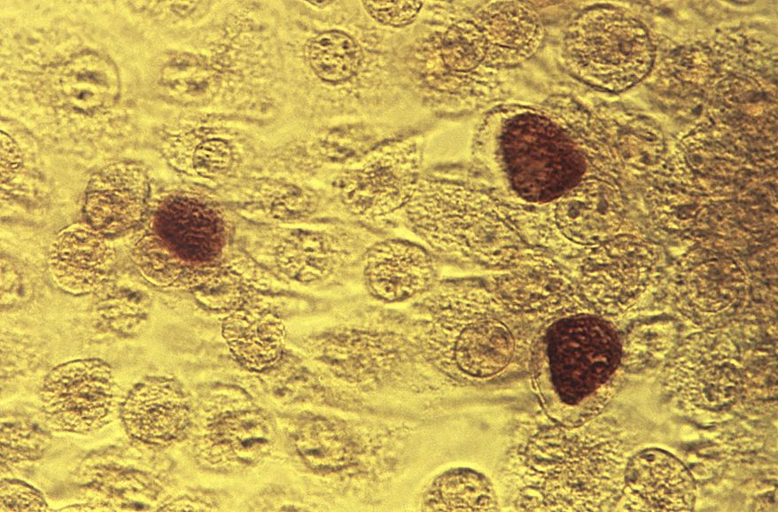 This 1975 file microscope image made available by the Centers for Disease Control and Prevention shows chlamydia trachomatis bacteria magnified 200 times. (Dr. E. Arum, Dr. N. Jacobs/CDC via AP) **FILE**