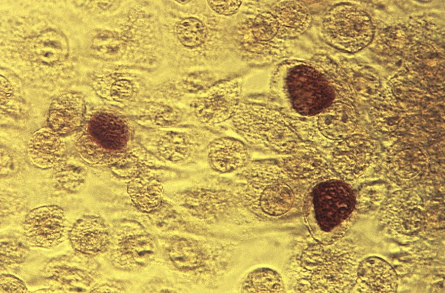 FILE - This 1975 microscope file image made available by the the Centers for Disease Control and Prevention shows Chlamydia trachomatis bacteria magnified 200X. A state report finds the number of cases of three major sexually transmitted diseases in California reached a 30-year high in 2018. The Department of Public Health said Tuesday that more than 336,000 cases of chlamydia, gonorrhea, and syphilis were reported. (Dr. E. Arum, Dr. N. Jacobs/CDC via AP, File)