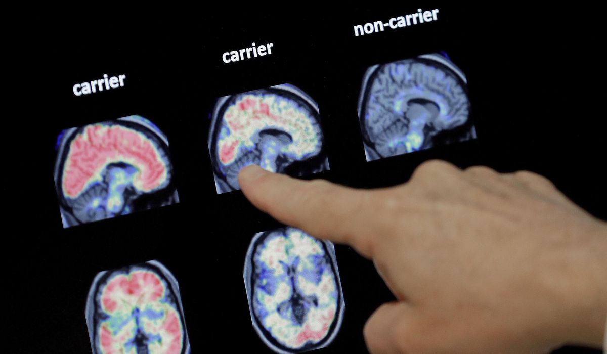 NextImg:Slower brain development puts boys at greater addiction risk: NIH