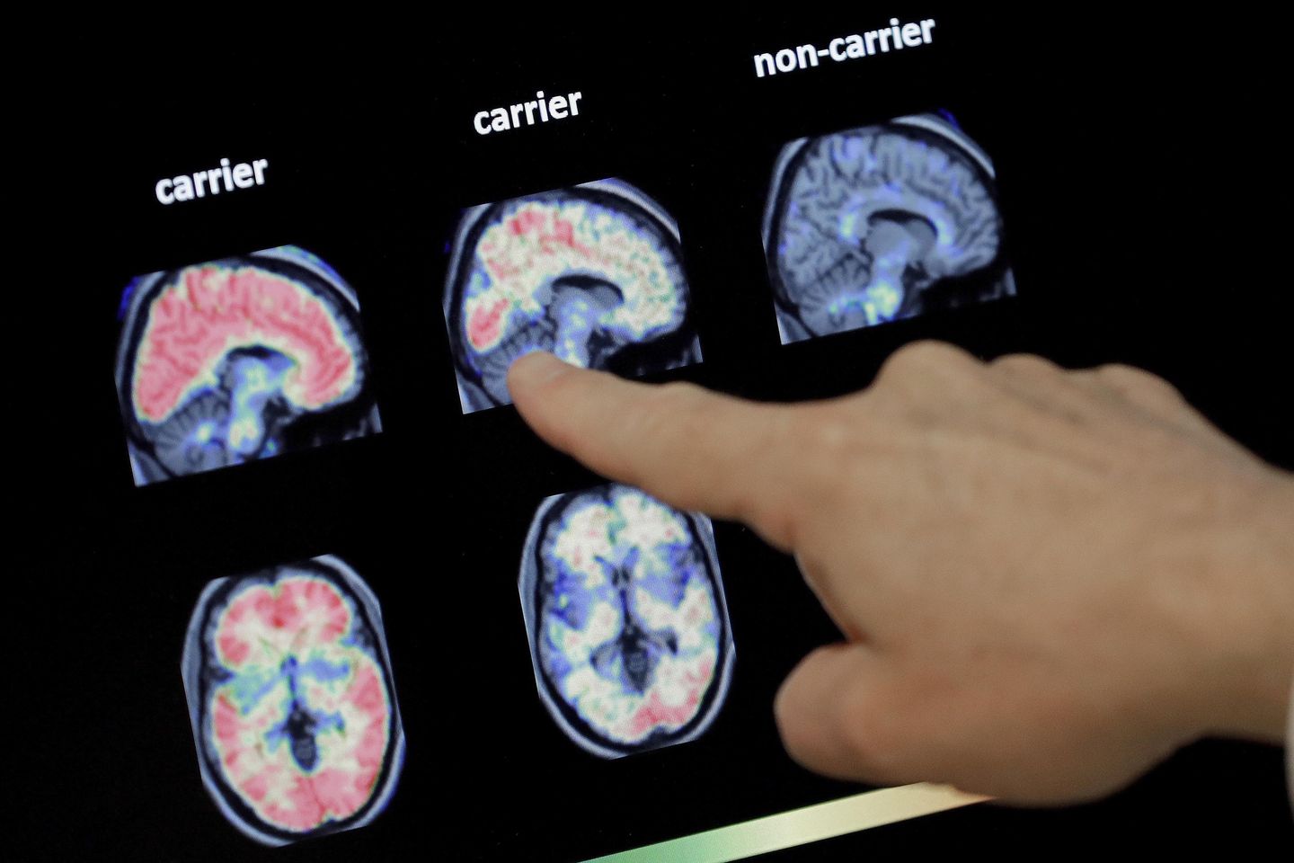 Slower brain development puts boys at greater addiction risk: NIH