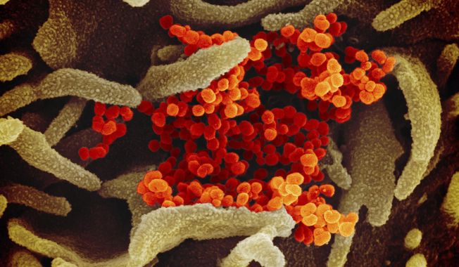 This image provided by The National Institute of Allergy and Infectious Diseases (NIAID). This scanning electron microscope image shows SARS-CoV-2 (orange)鈥攁lso known as 2019-nCoV, the virus that causes COVID-19鈥攊solated from a patient in the U.S., emerging from the surface of cells (green) cultured in the lab. (NIAID-RML via AP)