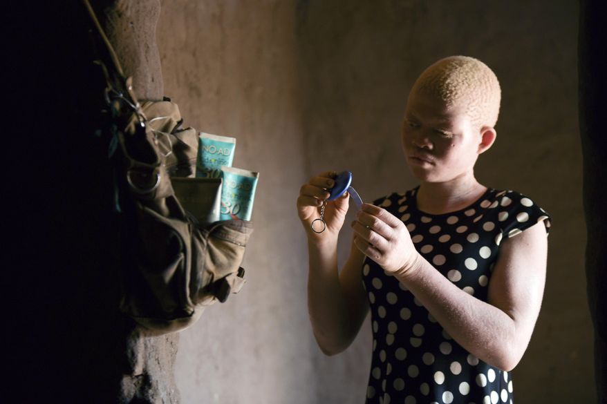 In this photo taken Sunday, Feb, 9, 2020, Catherine Amidu shows her protective alarm inside her home in Machinga, Malawi. People with albinism in several African countries live in fear of being abducted and killed in the mistaken belief that their body parts carry special powers and can be sold for thousands of dollars. 17-year-old Amidu survived an attempt on her life in 2017. (AP Photo/Thoko Chikondi)