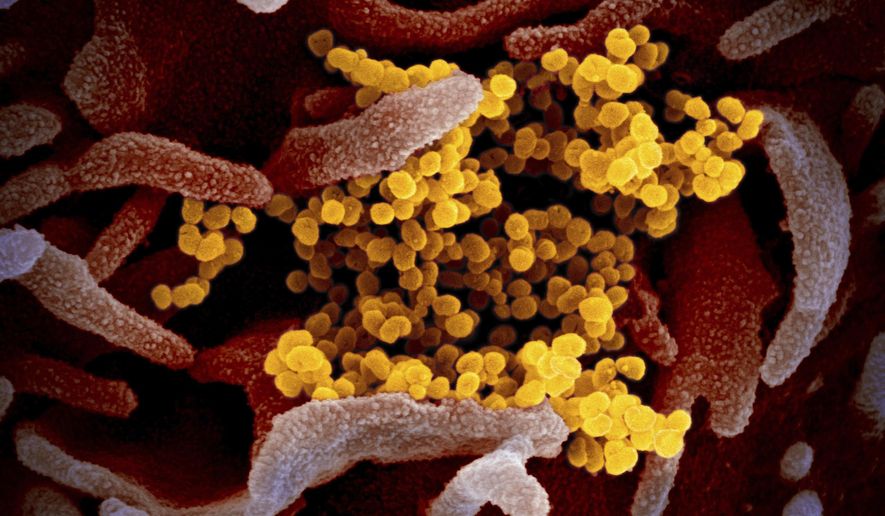 This undated electron microscope image made available by the U.S. National Institutes of Health in February 2020 shows the Novel Coronavirus SARS-CoV-2, yellow, emerging from the surface of cells, pink, cultured in the lab. Also known as 2019-nCoV, the virus causes COVID-19. The sample was isolated from a patient in the U.S. (NIAID-RML via AP) ** FILE **