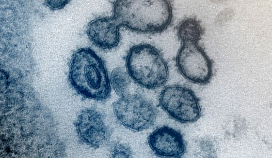 This undated electron microscope image made available by the U.S. National Institutes of Health in February 2020 shows the Novel Coronavirus SARS-CoV-2. Also known as 2019-nCoV, the virus causes COVID-19. The sample was isolated from a patient in the U.S. Dozens of research groups around the world are racing to create a vaccine as COVID-19 cases continue to grow. (NIAID-RML via AP)